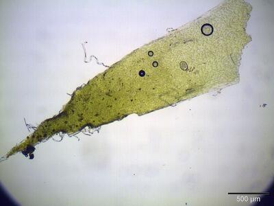 hedwigia ciliata perichaetialblatt