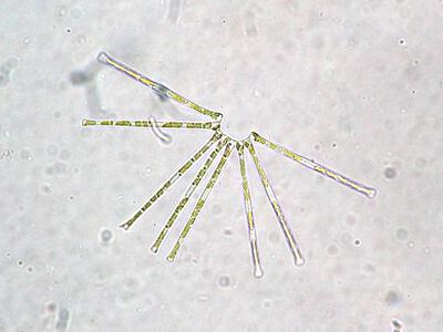 asterionella formosa