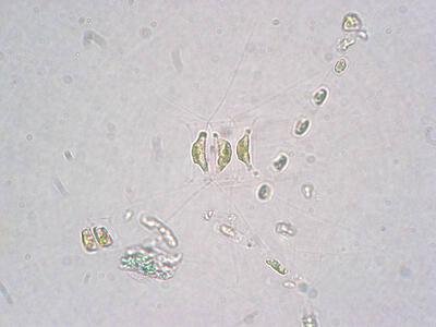 chaetoceros wighamii