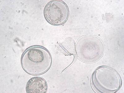 coscinodiscus granii