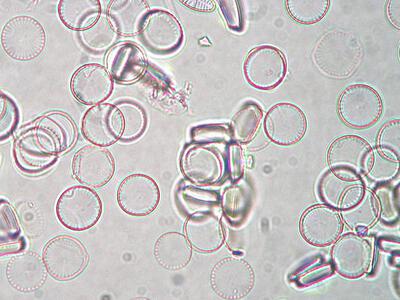 cyclostephanus invisitatus