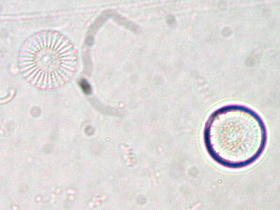 cyclotella radiosa