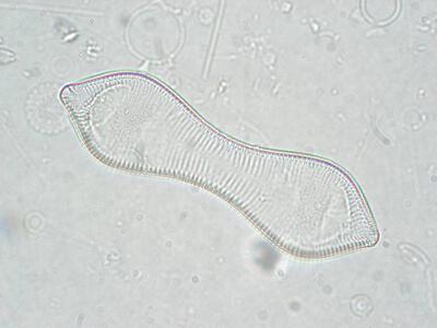 cymatopleura solea 2