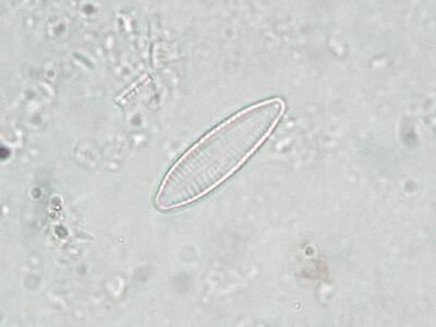 nitzschia palecea