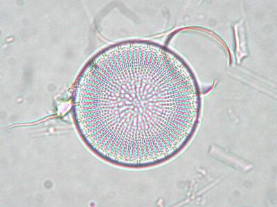 stephanodiscus neoastraea