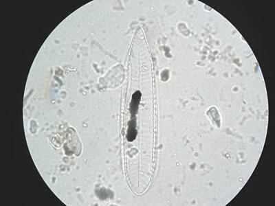 surirella ovata