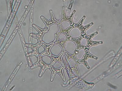 pediastrum duplex