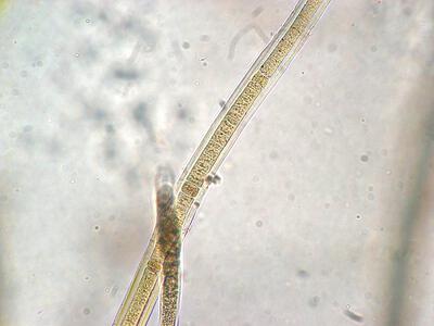 scytonema crispum heterocyste