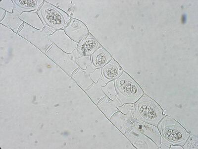 spirogyra sp konjugation