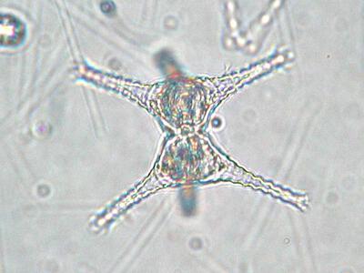 staurastrum sp