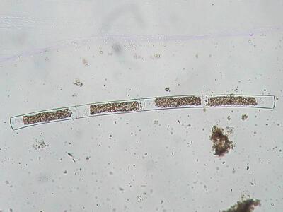 zygnema sp