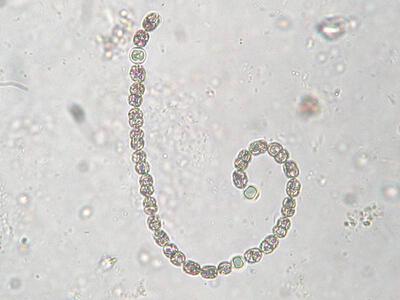 anabaena sp