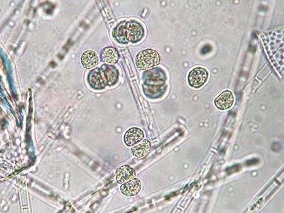 chroococcus limneticus