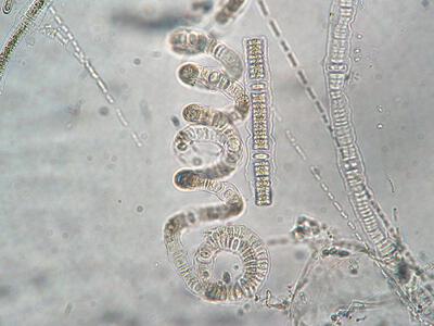 nodularia spumigena