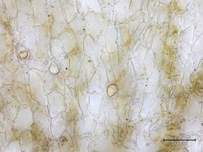 asterella lindenbergiana thallus oelzellen aufsicht