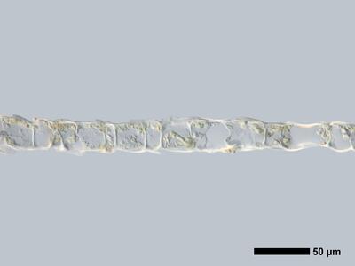 calypogeia fissa 1 flankenblatt quer detail