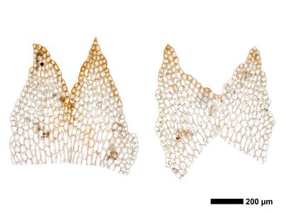 cephalozia ambigua 1 female bract