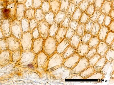 cephalozia ambigua 1 flankenblatt blattbasis