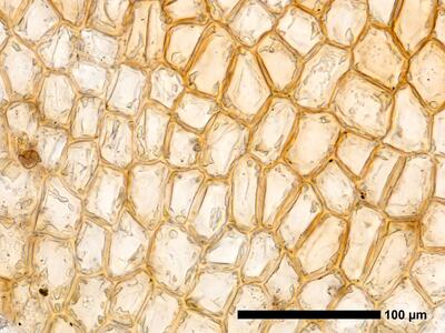 cephalozia ambigua 1 flankenblatt blattmitte