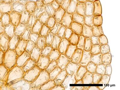 cephalozia ambigua 1 flankenblatt blattrand