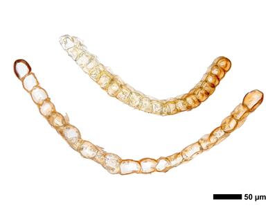 cephalozia ambigua 1 flankenblatt quer
