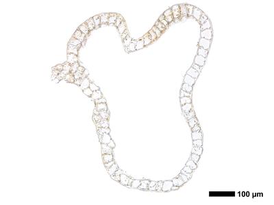 cephalozia ambigua 1 perianth basis quer