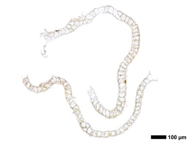 cephalozia ambigua 1 perianth mitte quer