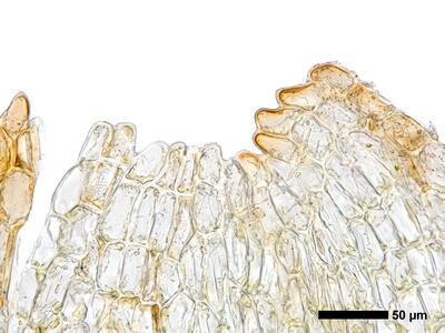 cephalozia ambigua 1 perianthmuendung
