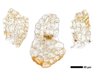 cephalozia ambigua 1 unterblatt
