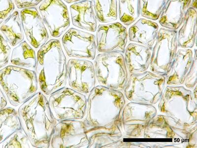 cephalozia bicuspidata 1 flankenblatt blattbasis