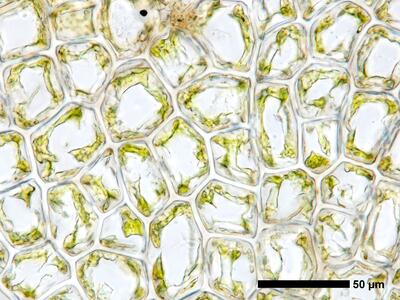 cephalozia bicuspidata 1 flankenblatt blattmitte