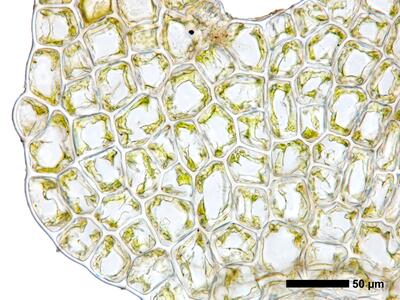 cephalozia bicuspidata 1 flankenblatt blattmitte blattrand