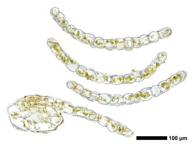 cephalozia bicuspidata 1 flankenblatt quer