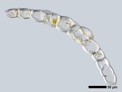 cephalozia bicuspidata 1 flankenblatt quer detail