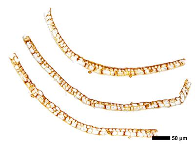 cephalozia bicuspidata 1 kapsel quer