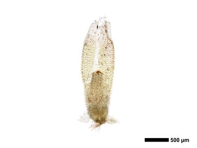 cephalozia bicuspidata 1 perianth