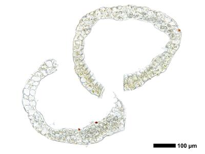 cephalozia bicuspidata 1 perianth basis quer