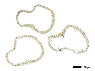 cephalozia bicuspidata 1 perianth mitte quer