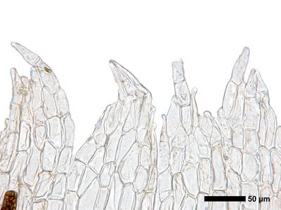 cephalozia bicuspidata 1 perianthmuendung
