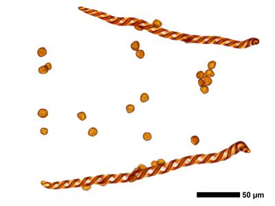 cephalozia bicuspidata 1 sporen elateren