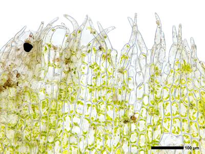 cephalozia bicuspidata 2 perianthmuendung