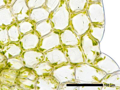cephalozia connivens 1 flankenblatt blattbasis