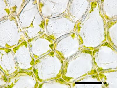 cephalozia connivens 1 flankenblatt blattmitte