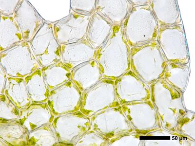 cephalozia connivens 1 flankenblatt blattmitte blattrand