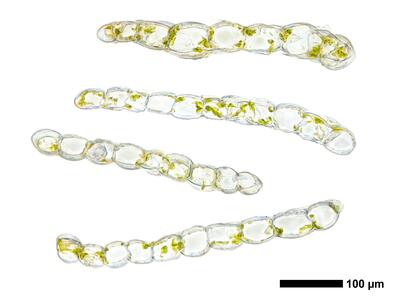 cephalozia connivens 1 flankenblatt quer