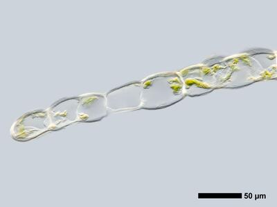cephalozia connivens 1 flankenblatt quer detail