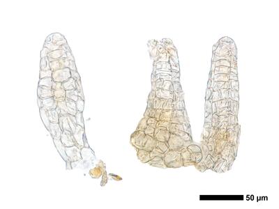 fuscocephaloziopsis 1 lunulifolia archegonien