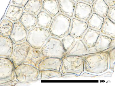 fuscocephaloziopsis 1 lunulifolia flankenblatt blattbasis