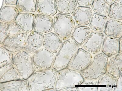 fuscocephaloziopsis 1 lunulifolia flankenblatt blattmitte