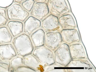 fuscocephaloziopsis 1 lunulifolia flankenblatt blattrand